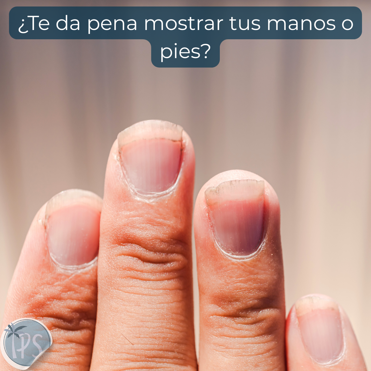 Kit Para Arreglo De Uñas Instrumentos Podologia Pedicure Kit Manicure Pedicure Negro