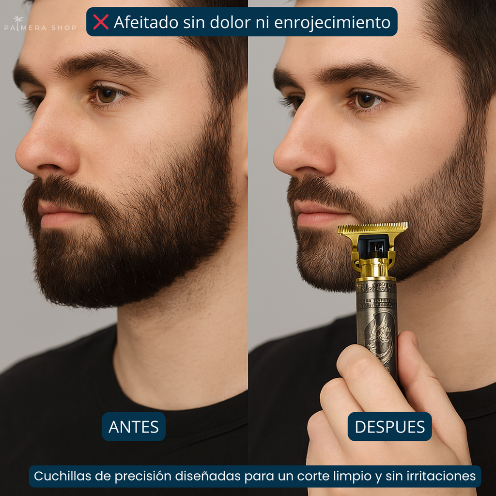 Maquina De Afeitar Hombre Inalambrica Afeitadoras Electricas Dorado 5